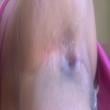 
Piscando