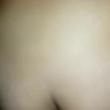 casal_ackr