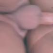 casal_cckld