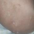 Mídia de corninhocasadadeluxo