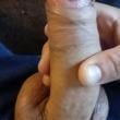 Mídia de douglas20cm