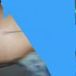 dougsanygpi