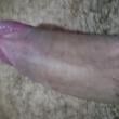 Mídia de kinge