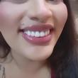 
Sorriso novo