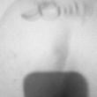 morenorp_33