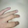 
Anal