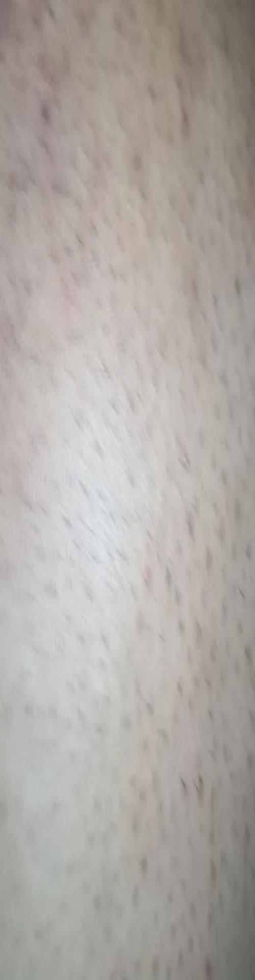 Mídia de chupador1961