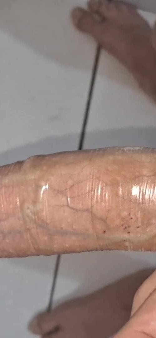 Mídia de maurinods
